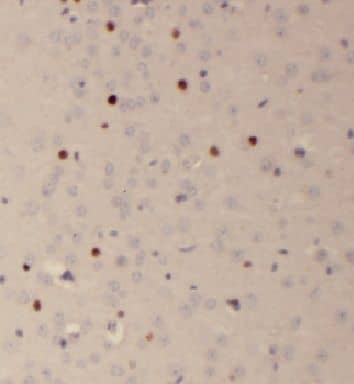 Immunohistochemistry: FAM118B Antibody - BSA Free [NBP3-46526] - Immunohistochemistry of paraffin-embedded human brain using (FAM118B antibody) at dilution of 1:100