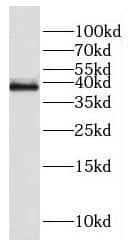Western Blot: FAM118B Antibody - BSA Free [NBP3-46526] - HeLa cells were subjected to SDS PAGE followed by western blot with (FAM118B antibody) at dilution of 1:500