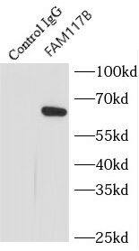 Immunoprecipitation: FAM117B Antibody - BSA Free [NBP3-46527] - IP Result of anti-FAM117B (IP:, 4ug; Detection: 1:500) with HEK-293 cells lysate 920ug.