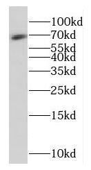 Western Blot: FAM117B Antibody - BSA Free [NBP3-46527] - HeLa cells were subjected to SDS PAGE followed by western blot with (FAM117B antibody) at dilution of 1:1000