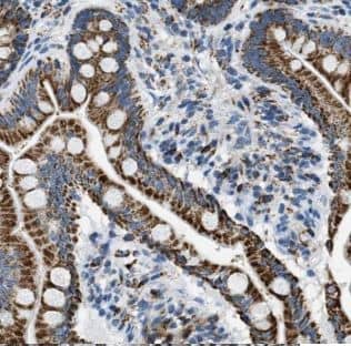 Immunohistochemistry: FAM111B Antibody - BSA Free [NBP3-46530] - Immunohistochemistry of paraffin-embedded human colon slide using (FAM111B Antibody) at dilution of 1:50