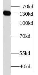 Western Blot: FAM111B Antibody - BSA Free [NBP3-46530] - HeLa cells were subjected to SDS PAGE followed by western blot with (FAM111B antibody) at dilution of 1:500