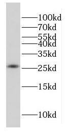 Western Blot: FAM101A Antibody - BSA Free [NBP3-46531] - HepG2 cells were subjected to SDS PAGE followed by western blot with (FAM101A antibody) at dilution of 1:500