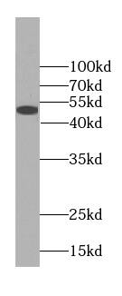 Western Blot FLAD1 Antibody - BSA Free