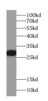 Western Blot: Factor XII heavy chain Antibody (4E7) - BSA Free [NBP3-46534] - K-562 cells were subjected to SDS PAGE followed by western blot with (Factor XII heavy chain antibody) at dilution of 1:1000