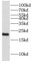 Western Blot: Exosome component 1 Antibody - BSA Free [NBP3-46539] - SGC-7901 cells were subjected to SDS PAGE followed by western blot with (Exosome component 1 antibody) at dilution of 1:200