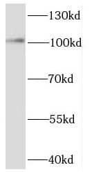 Western Blot: SEC3 Antibody - BSA Free [NBP3-46542] - Rat brain tissue were subjected to SDS PAGE followed by western blot with (SEC3 antibody) at dilution of 1:1000