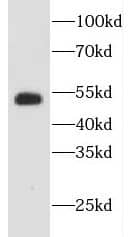 Western Blot: Enah/Vasp-like Antibody - BSA Free [NBP3-46544] - Jurkat cells were subjected to SDS PAGE followed by western blot with (Enah/Vasp-like antibody) at dilution of 1:200