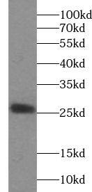 Western Blot: EVI2A Antibody - BSA Free [NBP3-46546] - Mouse liver tissue were subjected to SDS PAGE followed by western blot with (EVI2A antibody) at dilution of 1:300