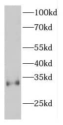 Western Blot: espin Antibody - BSA Free [NBP3-46548] - Mouse brain tissue were subjected to SDS PAGE followed by western blot with (espin antibody) at dilution of 1:200