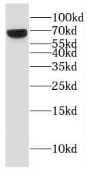 Western Blot: ESCO2 Antibody - BSA Free [NBP3-46550] - HeLa cells were subjected to SDS PAGE followed by western blot with (ESCO2 antibody) at dilution of 1:1000