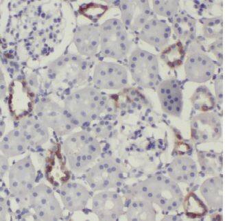Immunohistochemistry ERMP1 Antibody - BSA Free