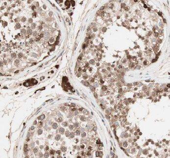 Immunohistochemistry HEXO Antibody - BSA Free
