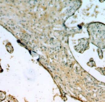 Immunohistochemistry: EPS8L2 Antibody - BSA Free [NBP3-46561] - Immunohistochemistry of paraffin-embedded human placenta using (EPS8L2 antibody) at dilution of 1:100