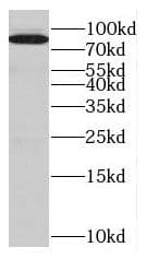 Western Blot EPS8L2 Antibody - BSA Free
