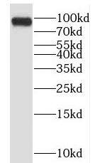 Western Blot: EPS15R Antibody - BSA Free [NBP3-46562] - BxPC-3 cells were subjected to SDS PAGE followed by western blot with (EPS15R antibody) at dilution of 1:500