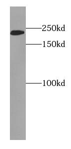 Western Blot: EVPL Antibody - BSA Free [NBP3-46565] - A431 cells were subjected to SDS PAGE followed by western blot with ( EVPL