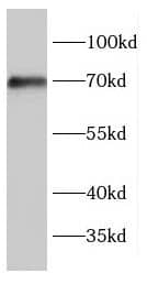Western Blot: ENTPD7 Antibody - BSA Free [NBP3-46567] - HeLa cells were subjected to SDS PAGE followed by western blot with ( ENTPD7 Antibody) at dilution of 1:300