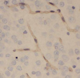 Immunohistochemistry: ENPP-4 Antibody - BSA Free [NBP3-46569] - Immunohistochemistry of paraffin-embedded human brain using (ENPP-4 antibody) at dilution of 1:100