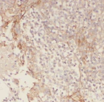 Immunohistochemistry: CNOX Antibody - BSA Free [NBP3-46570] - Immunohistochemistry of paraffin-embedded human tonsillitis slide using (CNOX Antibody) at dilution of 1:50