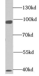 Western Blot: EML1 Antibody - BSA Free [NBP3-46572] - HepG2 cells were subjected to SDS PAGE followed by western blot with (EML1 antibody) at dilution of 1:300