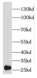 Western Blot: EMG1 Antibody - BSA Free [NBP3-46574] - HeLa cells were subjected to SDS PAGE followed by western blot with (EMG1 antibody) at dilution of 1:400