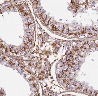 Immunohistochemistry ELOVL2 Antibody - BSA Free