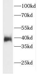 Western Blot: ELMOD1 Antibody - BSA Free [NBP3-46578] - Human brain tissue were subjected to SDS PAGE followed by western blot with (ELMOD1 antibody) at dilution of 1:500