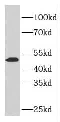 Western Blot: ELK4 Antibody - BSA Free [NBP3-46579] - HeLa cells were subjected to SDS PAGE followed by western blot with (ELK4 antibody) at dilution of 1:800