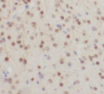 Immunohistochemistry: ELAVL2 Antibody - BSA Free [NBP3-46580] - Immunohistochemistry of paraffin-embedded human brain using (ELAVL2 antibody) at dilution of 1:100