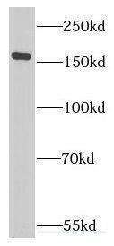 Western Blot: Eukaryotic translation initiation factor 5B Antibody - BSA Free [NBP3-46581] - Mouse brain tissue were subjected to SDS PAGE followed by western blot with (Eukaryotic translation initiation factor 5B antibody) at dilution of 1:500