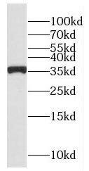 Western Blot: TRIP1 Antibody - BSA Free [NBP3-46584] - HEK-293 cells were subjected to SDS PAGE followed by western blot with (TRIP1 antibody) at dilution of 1:1000