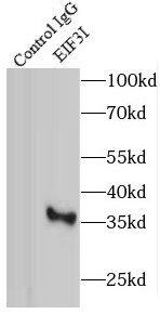 Immunoprecipitation: TRIP1 Antibody - BSA Free [NBP3-46584] - IP Result of anti-TRIP1 (IP:, 3ug; Detection: 1:1000) with HEK-293 cells lysate 1500ug.