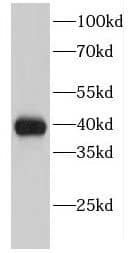 Western Blot: EIF2B2 Antibody - BSA Free [NBP3-46585] - K-562 cells were subjected to SDS PAGE followed by western blot with (EIF2B2 Antibody) at dilution of 1:1000