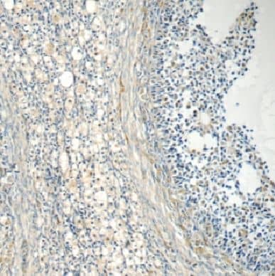 Immunohistochemistry: EIF2B2 Antibody - BSA Free [NBP3-46585] - Immunohistochemistry of paraffin-embedded human ovary tissue slide using (EIF2B2 Antibody) at dilution of 1:50