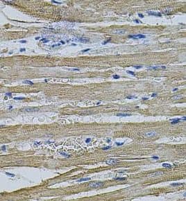 Immunohistochemistry EIF1AY Antibody - BSA Free