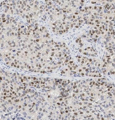 Immunohistochemistry EID1 Antibody - BSA Free