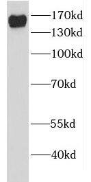 Western Blot: EDC4 Antibody - BSA Free [NBP3-46600] - HeLa cells were subjected to SDS PAGE followed by western blot with (EDC4 antibody) at dilution of 1:400