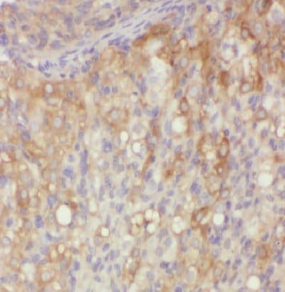 Immunohistochemistry VOPP1 Antibody - BSA Free