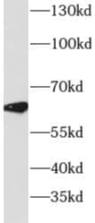 Western Blot: DYRK4 Antibody - BSA Free [NBP3-46607] - Mouse lung tissue were subjected to SDS PAGE followed by western blot with (DYRK4 antibody) at dilution of 1:500