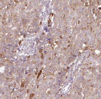 Immunohistochemistry DYNLT3 Antibody - BSA Free