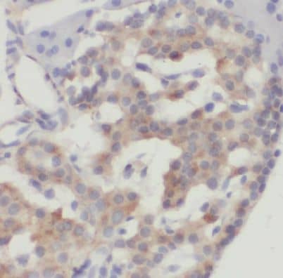 Immunohistochemistry DYNLT1 Antibody - BSA Free