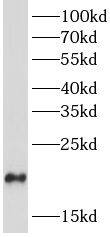 Western Blot Dynein light chain 2a cytoplasmic Antibody - BSA Free