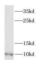 Western Blot: Dynein light chain 2 cytoplasmic Antibody - BSA Free [NBP3-46611] - Human heart tissue were subjected to SDS PAGE followed by western blot with (Dynein light chain 2 cytoplasmic antibody) at dilution of 1:400