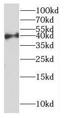 Western Blot: dynein, cytoplasmic 2, light intermediate chain 1 Antibody - BSA Free [NBP3-46612] - Human liver tissue were subjected to SDS PAGE followed by western blot with (dynein, cytoplasmic 2, light intermediate chain 1 antibody) at dilution of 1:500