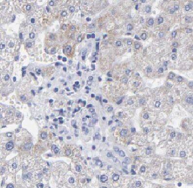 Immunohistochemistry: DUSP9 Antibody - BSA Free [NBP3-46615] - Immunohistochemistry of paraffin-embedded human liver tissue slide using (DUSP9 Antibody) at dilution of 1:100