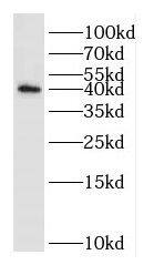 Western Blot DUSP11 Antibody - BSA Free