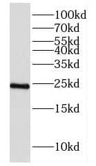 Western Blot: DUS4L Antibody - BSA Free [NBP3-46622] - Mouse kidney tissue were subjected to SDS PAGE followed by western blot with (DUS4L antibody) at dilution of 1:1000