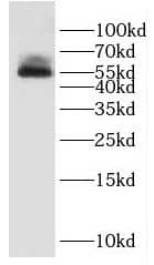 Western Blot: DUS1L Antibody - BSA Free [NBP3-46623] - Jurkat cells were subjected to SDS PAGE followed by western blot with (DUS1L antibody) at dilution of 1:1500