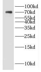 Western Blot: DTX4 Antibody - BSA Free [NBP3-46624] - Mouse kidney tissue were subjected to SDS PAGE followed by western blot with ( DTX4 Antibody) at dilution of 1:300